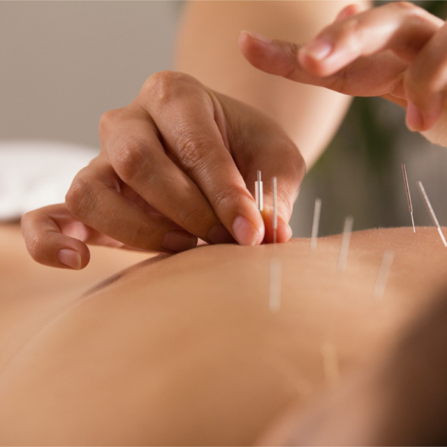 Acupuncture and Its Potential Role in Mainstream Care